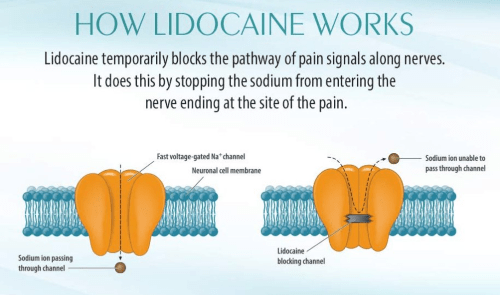 how lidocaine works