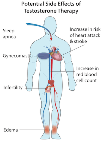 trt side effects