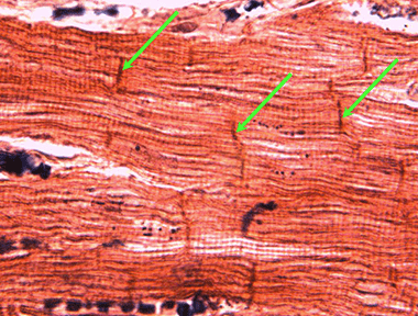 micro tears from pe devices