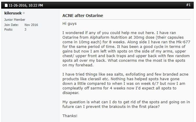 does ostarine cause acne