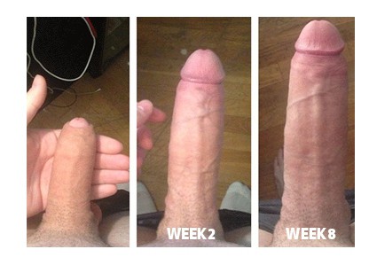 phalogenics before and after photo