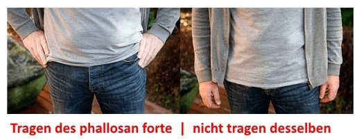 Tragen des phallosan forte - nicht tragen desselben