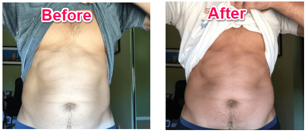 ultimate abs stimulator before and after