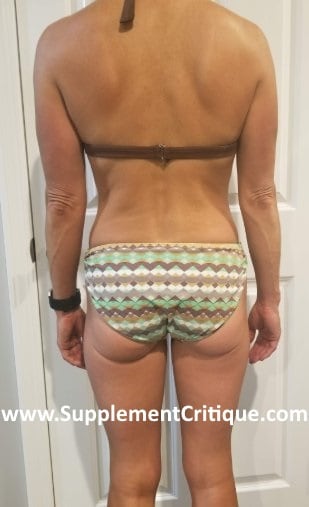 after photo burn ts week 4