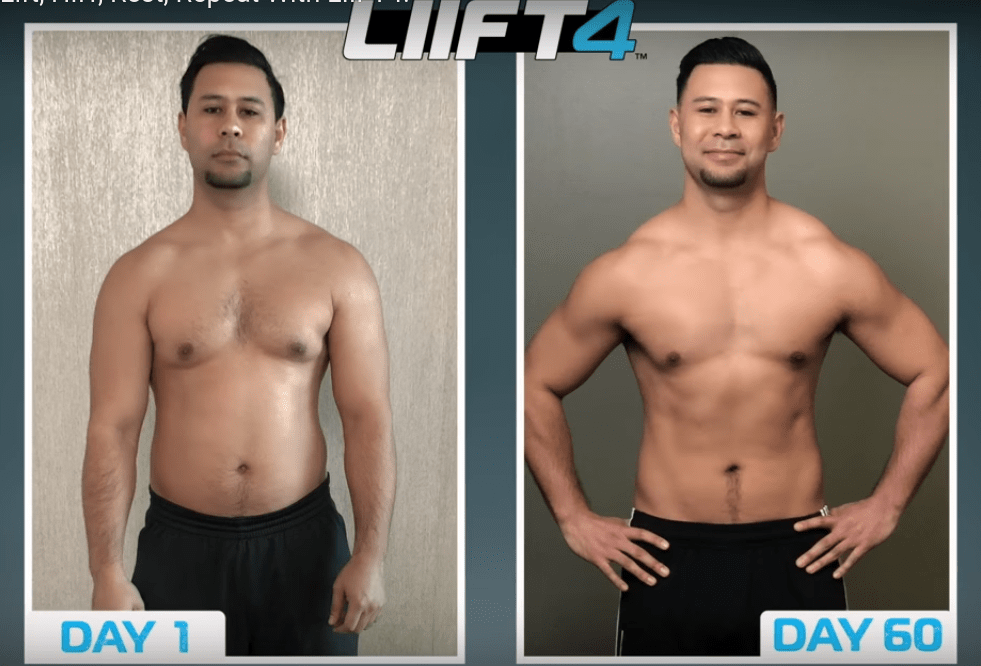 Before and after transformation picture of a LIIFT4 user